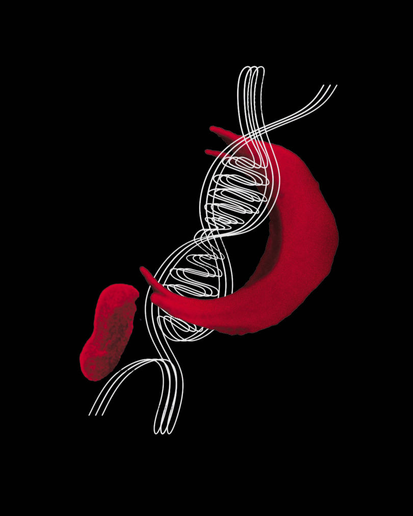 Inherited Pain: How sickle cell reveals the intergenerational violence of caste